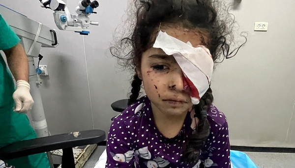 صحة غزة: نحو 1500 مواطن فقدوا بصرهم جراء حرب الإبادة