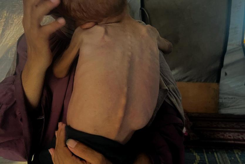 معاناة غزة تتفاقم: سكانها يشربون الماء المالح للبقاء على قيد الحياة
