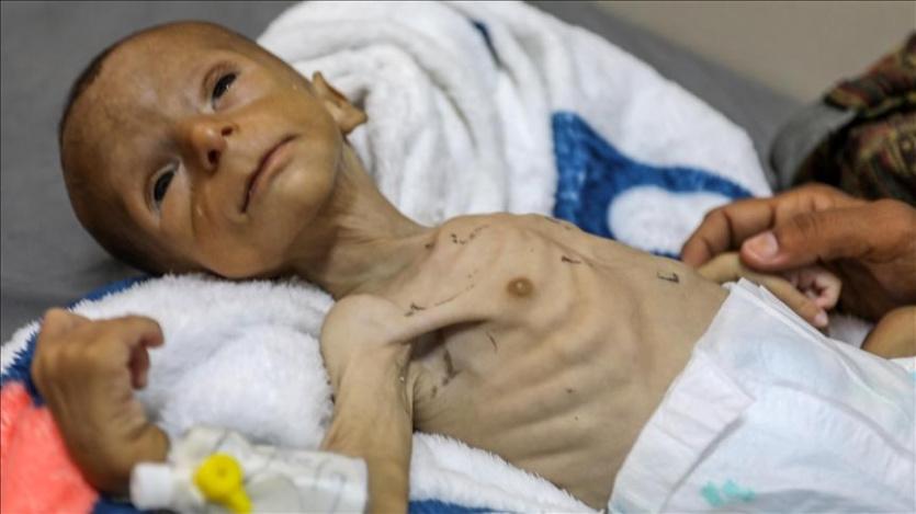  الأونروا: طفل من كل ثلاثة بغزة لم يتناول طعاما خلال 24 ساعة