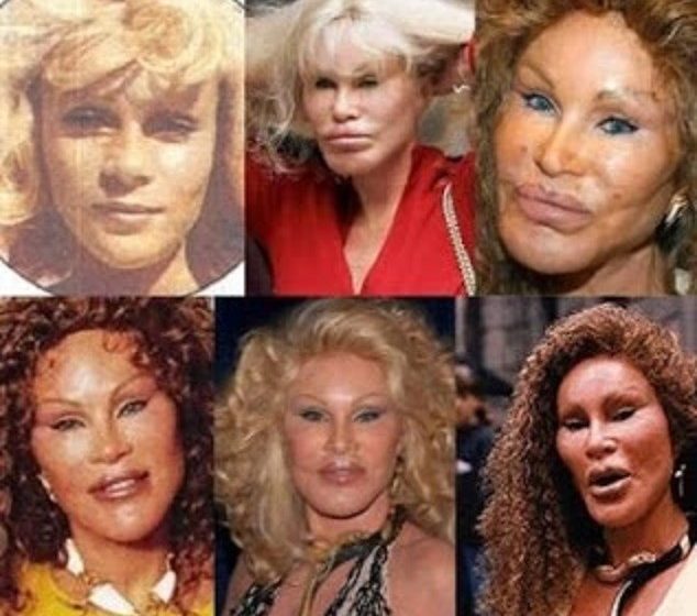  من هم أهم المشاهير الذين تشوهت ملامحهم بسبب عمليات التجميل 