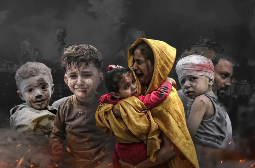  أطباء بلا حدود: نقص المستلزمات يهدد مصابي الحروق في غزة بتشوهات دائمة