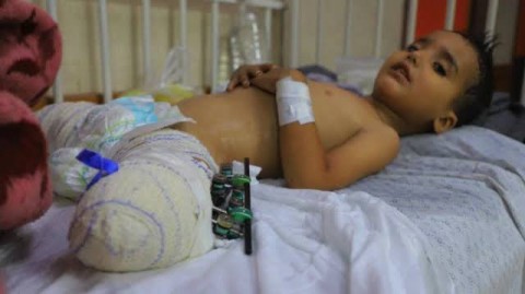  3 أعوام إبادة بغزة.. 10 آلاف طفل فقدوا ساقا على الأقل و9 قتلى من كل 10 مدنيون